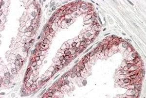 IHC-P analysis of human prostate using GTX89347 alpha 1 Catenin antibody, Internal. Antigen retrieval : citrate buffer pH 6 Dilution : 3.8microg/ml