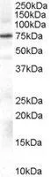 WB analysis of Daudi cell lysate using GTX89353 GRK2 antibody, Internal. Dilution : 0.3microg/ml Loading : 35microg protein in RIPA buffer WB analysis of Daudi cell lysate using GTX89353 GRK2 antibody, Internal. Dilution : 0.3microg/ml Loading : 35microg protein in RIPA buffer