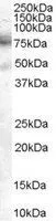 WB analysis of A431 cell lysate using GTX89354 DCP1A antibody, C-term. Dilution : 2microg/ml Loading : 35microg protein in RIPA buffer WB analysis of A431 cell lysate using GTX89354 DCP1A antibody, C-term. Dilution : 2microg/ml Loading : 35microg protein in RIPA buffer