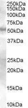 WB analysis of human skin lysate using GTX89360 SMAD9 antibody, Internal. Dilution : 0.3microg/ml Loading : 35microg protein in RIPA buffer WB analysis of human skin lysate using GTX89360 SMAD9 antibody, Internal. Dilution : 0.3microg/ml Loading : 35microg protein in RIPA buffer