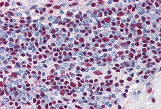 IHC-P analysis of human spleen using GTX89363 Ku80 antibody, Internal. Antigen retrieval : citrate buffer pH 6 Dilution : 5microg/ml