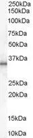 WB analysis of human adipose lysate using GTX89371 UCP1 antibody, C-term. Dilution : 1microg/ml Loading : 35microg protein in RIPA buffer