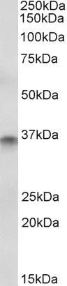 WB analysis of human colon lysate using GTX89372 CDX2 antibody, Internal. Dilution : 1microg/ml Loading : 35microg protein in RIPA buffer WB analysis of human colon lysate using GTX89372 CDX2 antibody, Internal. Dilution : 1microg/ml Loading : 35microg protein in RIPA buffer
