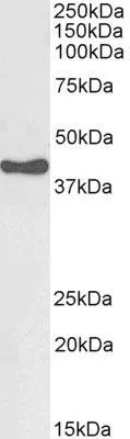 WB analysis of human adrenal gland lysate using GTX89377 HSD3B1 antibody, C-term. Dilution : 0.003microg/ml Loading : 35microg protein in RIPA buffer WB analysis of human adrenal gland lysate using GTX89377 HSD3B1 antibody, C-term. Dilution : 0.003microg/ml Loading : 35microg protein in RIPA buffer