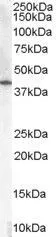 WB analysis of human placenta lysate using GTX89377 HSD3B1 antibody, C-term. Dilution : 0.01microg/ml Loading : 35microg protein in RIPA buffer