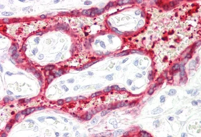 IHC-P analysis of human placenta using GTX89377 HSD3B1 antibody, C-term. Antigen retrieval : citrate buffer pH 6 Dilution : 3.75microg/ml