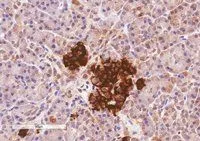 IHC-P analysis of human pancreas using GTX89386 CCKAR antibody,Internal. Antigen retrieval : citrate buffer pH 6 Dilution : 10ug/ml