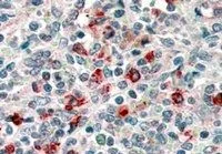 IHC-P analysis of human spleen using GTX89394 CD14 antibody, Internal. Antigen retrieval : citrate buffer pH 6 Dilution : 4microg/ml