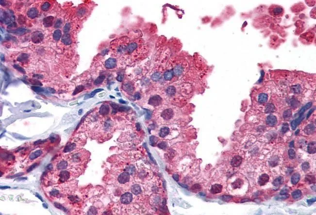 IHC-P analysis of human prostate using GTX89403 PDE4B antibody, C-term. Antigen retrieval : citrate buffer pH 6 Dilution : 5microg/ml