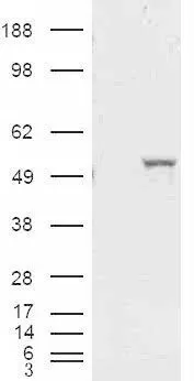 WB analysis of HEK293 overexpressing ALDH1A1 (mock transfection in first lane) using GTX89404 ALDH1A1 antibody, Internal.