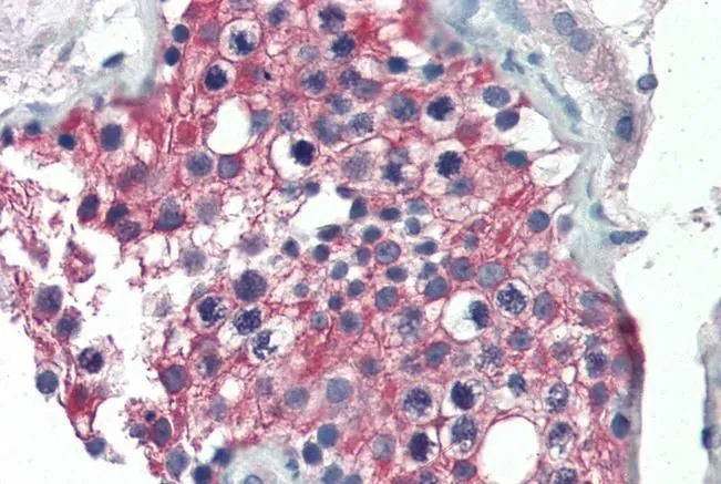 IHC-P analysis of human testis using GTX89404 ALDH1A1 antibody, Internal. Antigen retrieval : citrate buffer pH 6 Dilution : 5microg/ml
