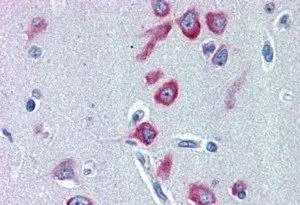 IHC-P analysis of human cerebral cortex using GTX89406 PCK1 antibody, Internal. Antigen retrieval : citrate buffer pH 6 Dilution : 2microg/ml IHC-P analysis of human cerebral cortex using GTX89406 PCK1 antibody, Internal. Antigen retrieval : citrate buffer pH 6 Dilution : 2microg/ml