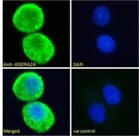 ICC/IF analysis of PFA fixed HepG2 cells using GTX89407 Adenosine A2a Receptor antibody,C-term. Green : Primary antibody Blue : DAPI Negative control : Unimmunized goat IgG Permeabilization : 0.15% Triton Dilution : 10ug/ml