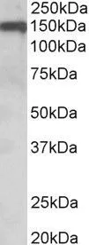 WB analysis of human amygdala lysate using GTX89414 OMG antibody, Internal. Dilution : 0.1microg/ml Loading : 35microg protein in RIPA buffer WB analysis of human amygdala lysate using GTX89414 OMG antibody, Internal. Dilution : 0.1microg/ml Loading : 35microg protein in RIPA buffer