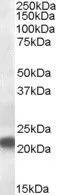 WB analysis of rat kidney lysate using GTX89428 VPS25 antibody, Internal. Dilution : 0.5microg/ml Loading : 35microg protein in RIPA buffer WB analysis of rat kidney lysate using GTX89428 VPS25 antibody, Internal. Dilution : 0.5microg/ml Loading : 35microg protein in RIPA buffer
