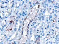 IHC-P analysis of human kidney using GTX89428 VPS25 antibody, Internal. Antigen retrieval : Tris/EDTA buffer pH 9 Dilution : 10microg/ml