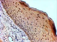 IHC-P analysis of human skin using GTX89431 14-3-3 sigma antibody, Internal. Antigen retrieval : Tris/EDTA buffer pH 9 Dilution : 2microg/ml
