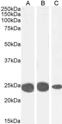 WB analysis of K562 (A), MCF7 (B) and NIH-3T3 (C) cell lysate using GTX89432 HP1 alpha antibody, Internal. Dilution : 0.1microg/ml Loading : 35microg protein in RIPA buffer