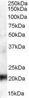 WB analysis of A431 lysate using GTX89454 HP1 gamma antibody, Internal. Dilution : 0.3microg/ml Loading : 35microg protein in RIPA buffer WB analysis of A431 lysate using GTX89454 HP1 gamma antibody, Internal. Dilution : 0.3microg/ml Loading : 35microg protein in RIPA buffer