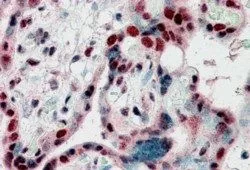 IHC-P analysis of human placenta using GTX89454 HP1 gamma antibody, Internal. Antigen retrieval : citrate buffer pH 6 Dilution : 2.5microg/ml