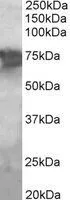 WB analysis of human liver lysate using GTX89464 PCK2 antibody, Internal. Dilution : 2microg/ml Loading : 35microg protein in RIPA buffer WB analysis of human liver lysate using GTX89464 PCK2 antibody, Internal. Dilution : 2microg/ml Loading : 35microg protein in RIPA buffer