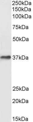 WB analysis of human liver lysate using GTX89467 DARC antibody, N-term. Dilution : 0.3microg/ml Loading : 35microg protein in RIPA buffer WB analysis of human liver lysate using GTX89467 DARC antibody, N-term. Dilution : 0.3microg/ml Loading : 35microg protein in RIPA buffer