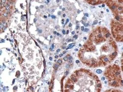 IHC-P analysis of human kidney using GTX89467 DARC antibody, N-term. Antigen retrieval : citrate buffer Ph 6 Dilution : 3microg/ml