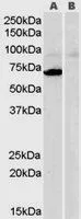 WB analysis of human heart lysate with (B) and without (A) blocking with the immunising peptide using GTX89475 Monoamine Oxidase A antibody, Internal. Dilution : 0.3microg/ml Loading : 35microg protein in RIPA buffer WB analysis of human heart lysate with (B) and without (A) blocking with the immunising peptide using GTX89475 Monoamine Oxidase A antibody, Internal. Dilution : 0.3microg/ml Loading : 35microg protein in RIPA buffer