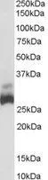 WB analysis of human liver lysate using GTX89491 SDHB antibody, C-term. Dilution : 0.03microg/ml Loading : 35microg protein in RIPA buffer WB analysis of human liver lysate using GTX89491 SDHB antibody, C-term. Dilution : 0.03microg/ml Loading : 35microg protein in RIPA buffer