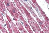 IHC-P analysis of human heart using GTX89491 SDHB antibody, C-term. Antigen retrieval : citrate buffer pH 6 Dilution : 5microg/ml