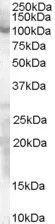 WB analysis of HeLa lysate using GTX89511 SP1 antibody, Internal. Dilution : 0.3microg/ml Loading : 30microg protein in RIPA buffer WB analysis of HeLa lysate using GTX89511 SP1 antibody, Internal. Dilution : 0.3microg/ml Loading : 30microg protein in RIPA buffer