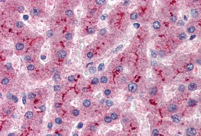 IHC-P analysis of human liver using GTX89512 Factor H antibody, Internal. Antigen retrieval : citrate buffer pH 6 Dilution : 5microg/ml