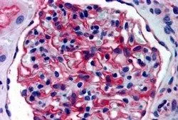 IHC-P analysis of human kidney using GTX89515 Aminopeptidase A antibody, Internal. Antigen retrieval : citrate buffer pH 6 Dilution : 3.8microg/ml