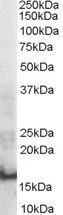 WB analysis of human thymus lysate using GTX89516 SH2D1A antibody, Internal. Dilution : 0.3microg/ml Loading : 30microg protein in RIPA buffer WB analysis of human thymus lysate using GTX89516 SH2D1A antibody, Internal. Dilution : 0.3microg/ml Loading : 30microg protein in RIPA buffer