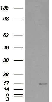 WB analysis of HEK293 overexpressing SH2D1A (mock transfection in first lane) using GTX89516 SH2D1A antibody, Internal.