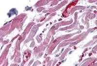 IHC-P analysis of human heart using GTX89517 RAE1 antibody, C-term. Antigen retrieval : citrate buffer pH 6 Dilution : 3.75microg/ml
