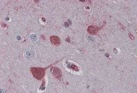 IHC-P analysis of human cortex using GTX89517 RAE1 antibody, C-term. Antigen retrieval : citrate buffer pH 6 Dilution : 3.8microg/ml