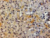 IHC-P analysis of human liver using GTX89521 LRP5 antibody, Internal. Antigen retrieval : citrate buffer pH 6 Dilution : 2microg/ml