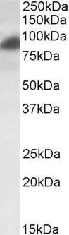 WB analysis of HeLa lysate using GTX89523 RAB11FIP1 antibody, Internal. Dilution : 0.2microg/ml Loading : 35microg protein in RIPA buffer WB analysis of HeLa lysate using GTX89523 RAB11FIP1 antibody, Internal. Dilution : 0.2microg/ml Loading : 35microg protein in RIPA buffer