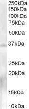 WB analysis of human testis lysate using GTX89524 NANOS1 antibody, C-term. Dilution : 0.3microg/ml Loading : 35microg protein in RIPA buffer WB analysis of human testis lysate using GTX89524 NANOS1 antibody, C-term. Dilution : 0.3microg/ml Loading : 35microg protein in RIPA buffer