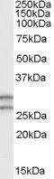 WB analysis of human testis lysate using GTX89530 COMT antibody, N-term. Dilution : 0.3microg/ml Loading : 35microg protein in RIPA buffer WB analysis of human testis lysate using GTX89530 COMT antibody, N-term. Dilution : 0.3microg/ml Loading : 35microg protein in RIPA buffer