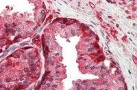 IHC-P analysis of human prostate using GTX89536 GSTP1 antibody, Internal. Antigen retrieval : citrate buffer pH 6 Dilution : 5microg/ml