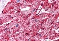 IHC-P analysis of human heart using GTX89541 Caveolin 1 antibody, Internal. Antigen retrieval : citrate buffer pH 6 Dilution : 5microg/ml