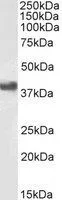 WB analysis of Daudi cell lysate using GTX89542 CD32B antibody, C-term. Dilution : 1microg/ml Loading : 35microg protein in RIPA buffer WB analysis of Daudi cell lysate using GTX89542 CD32B antibody, C-term. Dilution : 1microg/ml Loading : 35microg protein in RIPA buffer