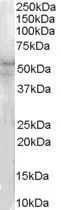 WB analysis of HeLa lysate using GTX89550 IRAK4 antibody, N-term. Dilution : 1microg/ml Loading : 35microg protein in RIPA buffer WB analysis of HeLa lysate using GTX89550 IRAK4 antibody, N-term. Dilution : 1microg/ml Loading : 35microg protein in RIPA buffer