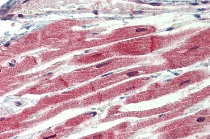 IHC-P analysis of human heart using GTX89550 IRAK4 antibody, N-term. Antigen retrieval : citrate buffer pH 6 Dilution : 3.75microg/ml