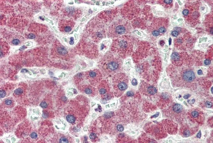 IHC-P analysis of human liver using GTX89550 IRAK4 antibody, N-term. Antigen retrieval : citrate buffer pH 6 Dilution : 3.75microg/ml
