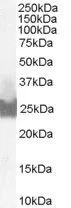 WB analysis of A431 lysate using GTX89562 Bid antibody, C-term. Dilution : 0.1microg/ml Loading : 35microg protein in RIPA buffer WB analysis of A431 lysate using GTX89562 Bid antibody, C-term. Dilution : 0.1microg/ml Loading : 35microg protein in RIPA buffer