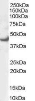 WB analysis of HEK293 lysate using GTX89563 ERK1 antibody, N-term. Dilution : 0.3microg/ml Loading : 35microg protein in RIPA buffer WB analysis of HEK293 lysate using GTX89563 ERK1 antibody, N-term. Dilution : 0.3microg/ml Loading : 35microg protein in RIPA buffer
