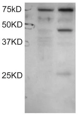 WB analysis of COS1 cell lysates untransfected (left lane) and transfected with full length recombinant human DYX1C1 (right lane) using GTX89566 DYX1C1 (Isoform a) antibody, C-term. Dilution : 0.1microg/ml Loading : 30microg protein in RIPA buffer WB analysis of COS1 cell lysates untransfected (left lane) and transfected with full length recombinant human DYX1C1 (right lane) using GTX89566 DYX1C1 (Isoform a) antibody, C-term. Dilution : 0.1microg/ml Loading : 30microg protein in RIPA buffer